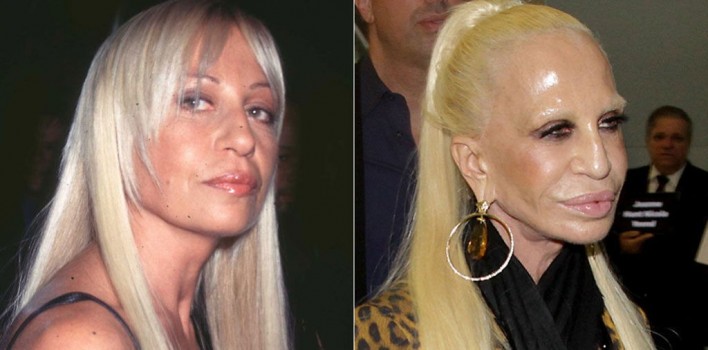 Canalladas perpetradas por cirujanos plásticos 74 Canalladas perpetradas por cirujanos plásticos