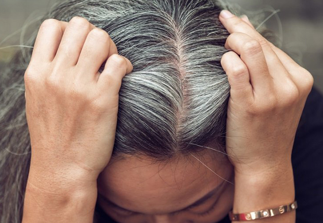Principales causas de la aparición de canas