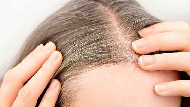 Personas más propensas a padecer de canas