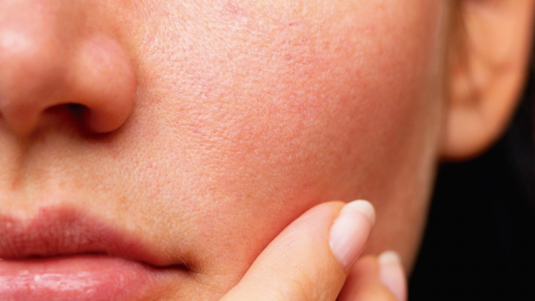 Cómo tener una piel hidratada si la tienes seca