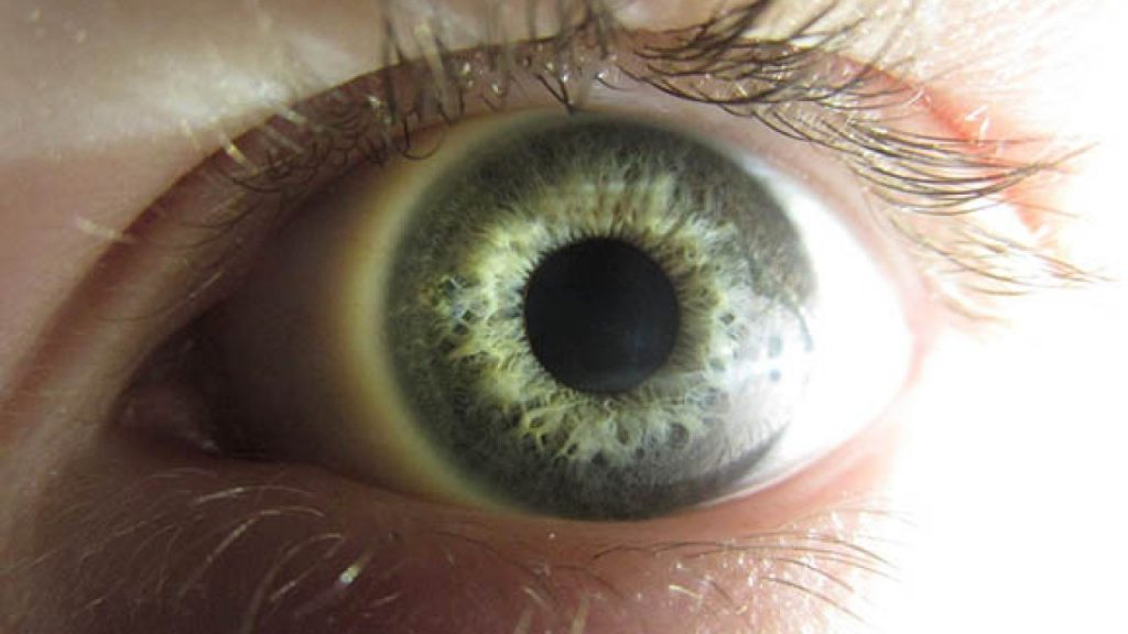 Síntomas poco conocidos de la Covid-19 que son peligrosos