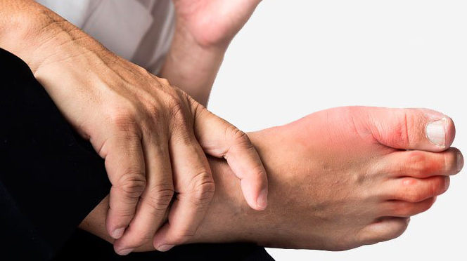 Diagnostico médico para los sabañones