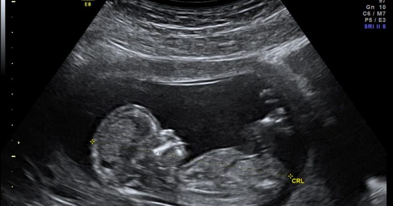 Investigadores identifican nanopartículas que podrían tratar enfermedades genéticas antes de nacer