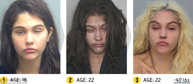 El antes y después de la gente que tomó muchas drogas 5