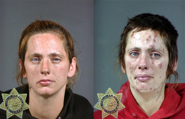 El antes y después de la gente que tomó muchas drogas 6