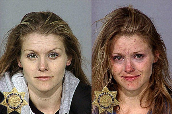 El antes y después de la gente que tomó muchas drogas 7