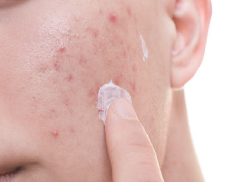 Factores que empeoran el maskné