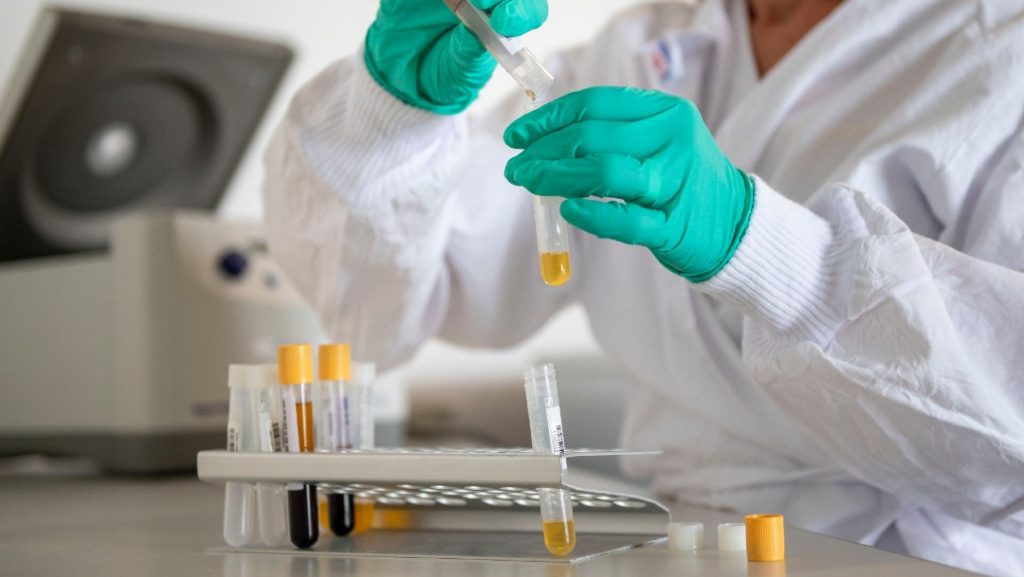 Cómo controlar el exceso de sudor 1 Análisis y pruebas de sudor