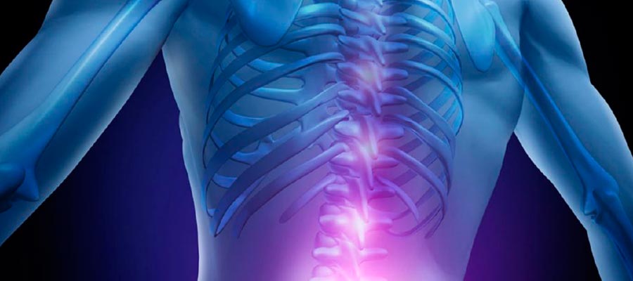 Qué es la medula espinal 3 Nivel de lesión