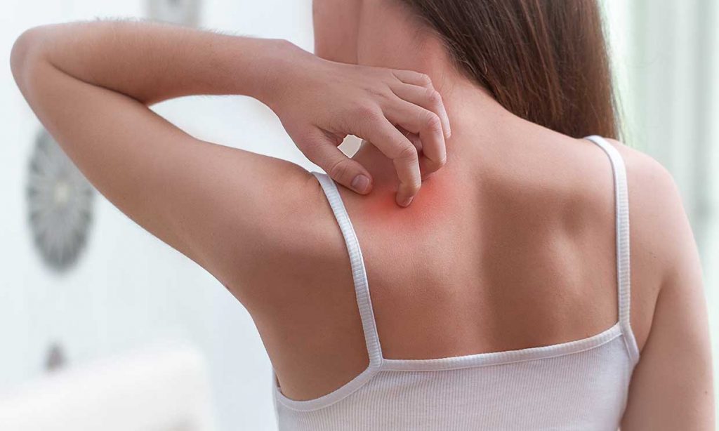 ¿Te pica la espalda? Puede ser un problema de salud 21 Expertos hablan sobre la relación entre el picor de espalda y tu salud