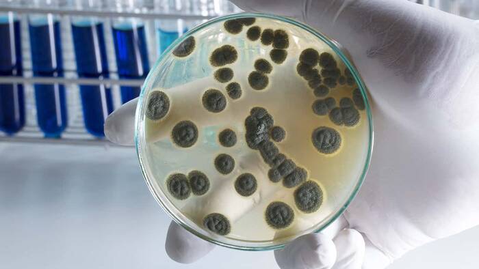 Qué es la penicilina 1 Historia de la penicilina