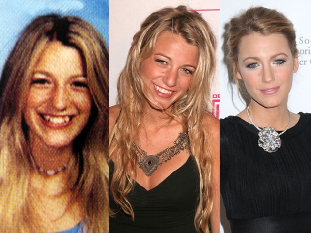 Patricia Conde y otras 10 Famosas que SÍ acertaron con el cirujano