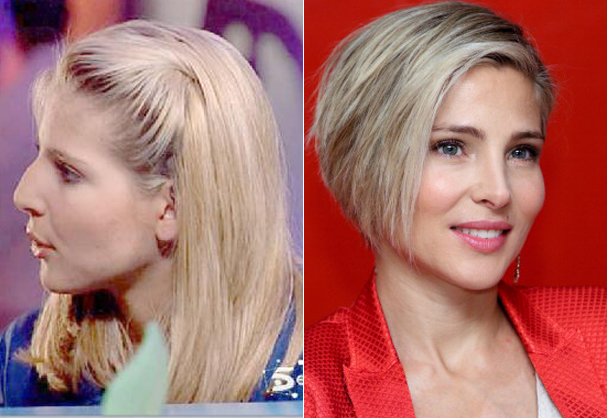 Patricia Conde y otras 10 Famosas que SÍ acertaron con el cirujano