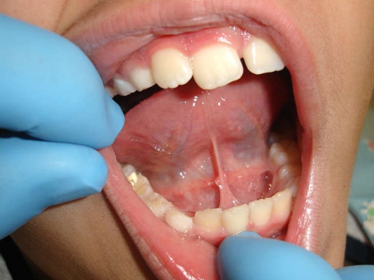 ¿Cómo detectar anomalías?