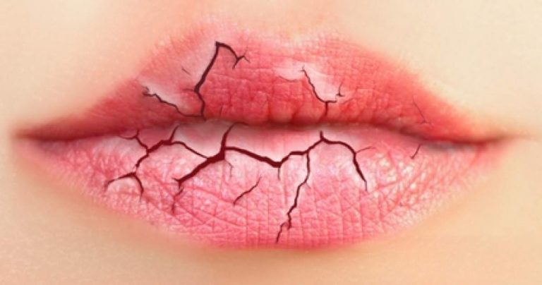 Cómo cuidar tu piel con las heladas y el frío del temporal Filomena