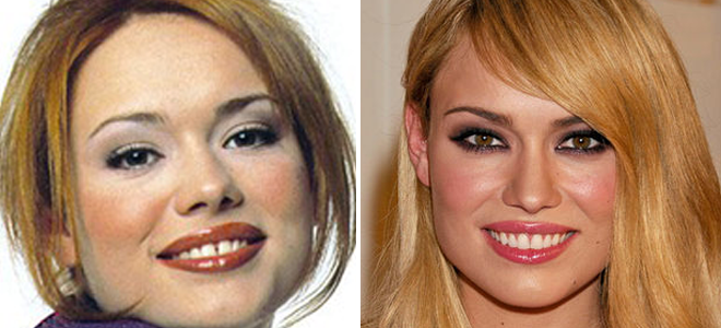 Patricia Conde y otras 10 Famosas que SÍ acertaron con el cirujano