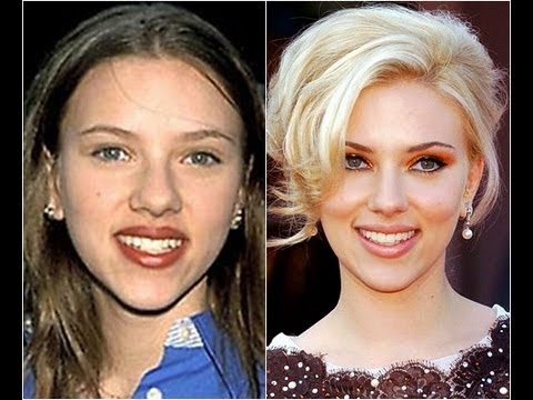 Patricia Conde y otras 10 Famosas que SÍ acertaron con el cirujano