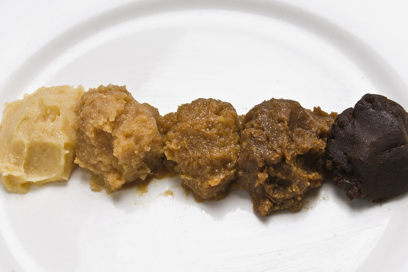 Qué es el miso 1 ¿Cuáles son los tipos de miso?