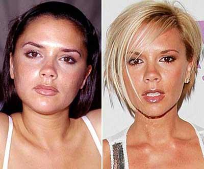 Patricia Conde y otras 10 Famosas que SÍ acertaron con el cirujano