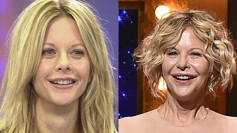 9 Famosos que cambiaron su rostro con cirugía y se desgraciaron