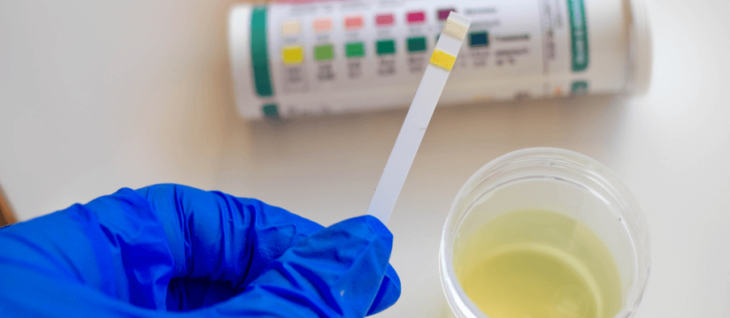 Cómo aliviar la cistitis o infección urinaria 150 Tipos de infección urinaria