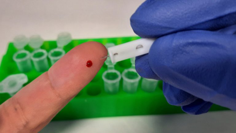 Castilla y León registra 1.645 nuevos casos y 36 fallecidos