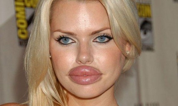 Cirujanos a los que se les fue la mano con la silicona 01