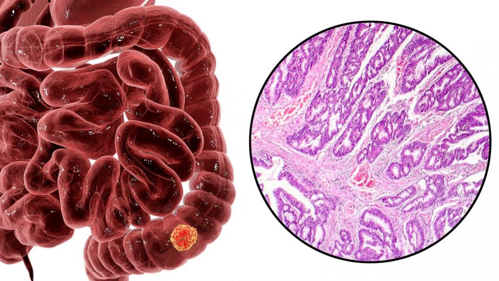 Evaluación del estudio