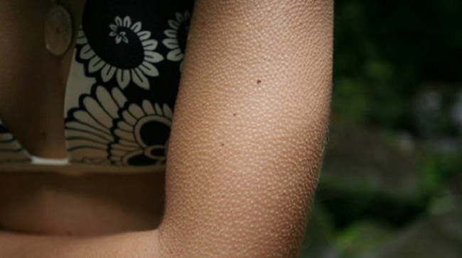 Cosas extrañas de tu cuerpo que no sospechabas que son mecanismos de defensa 07