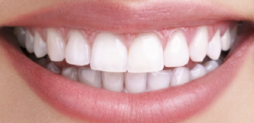 Un mundial con sonrisas blancas