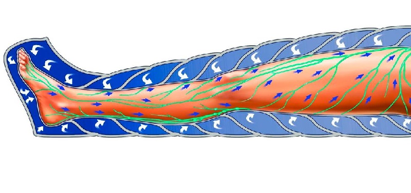 Funcionamiento de la presoterapia
