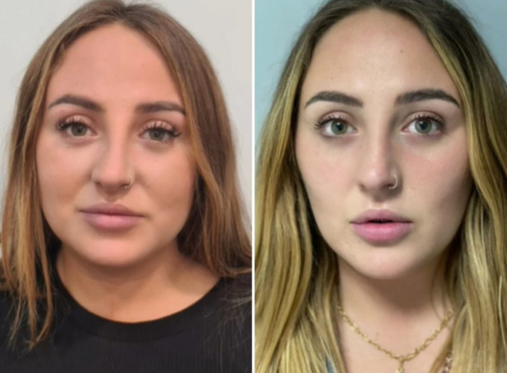 Rocío Flores el nuevo retoque estético que la ha transformado por completo