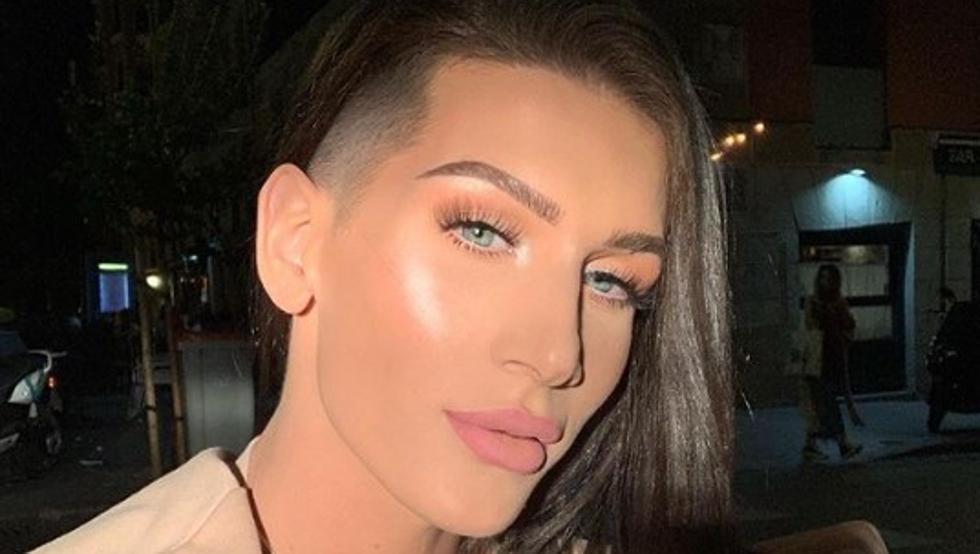 Oto Vans (Supervivientes) el antes y el impresionante después tras su cirugía