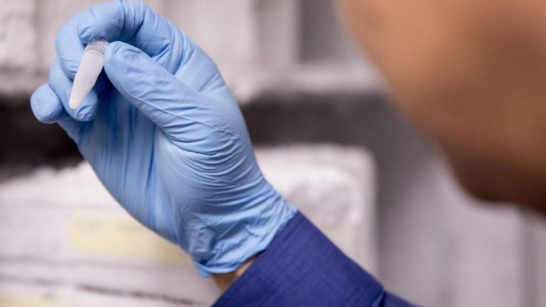 La pandemia deja más de 465.000 casos en el último día y roza los 105 millones de contagios