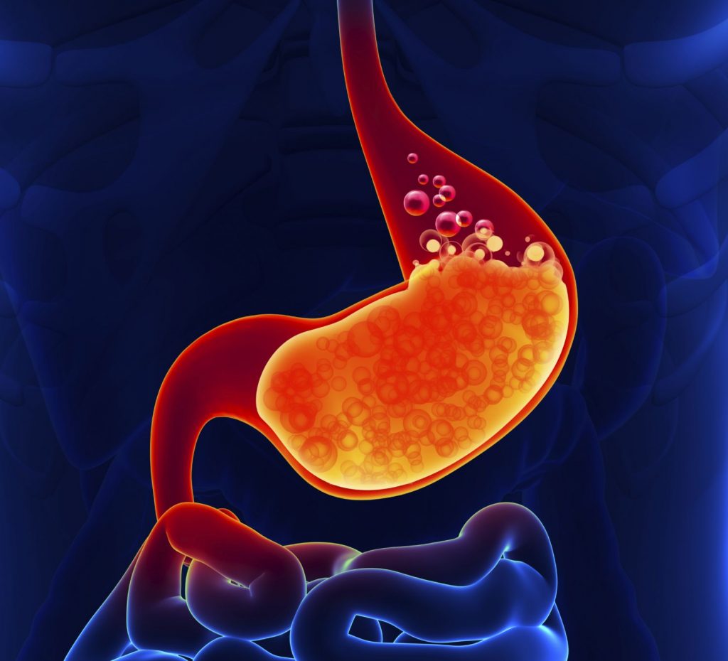 Por qué se produce la acidez estomacal