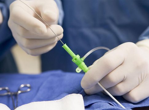 Qué es cateterismo Qué es cateterismo