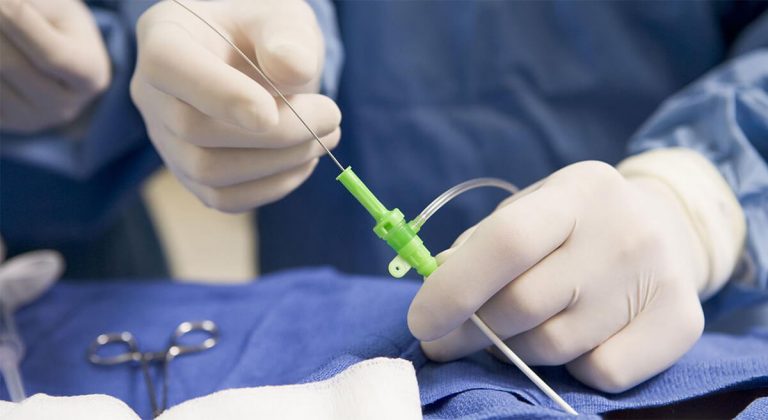 Qué es un cateterismo