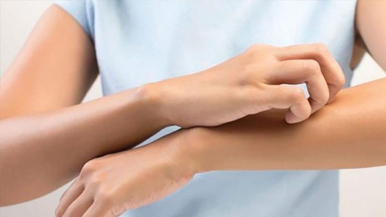 Qué es la colestasis