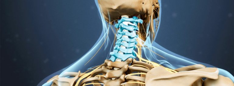 Qué es la lordosis cervical