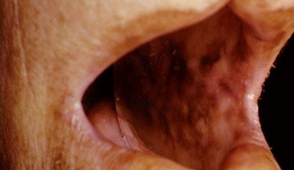 ¿Qué estudia la Endocrinopatía?