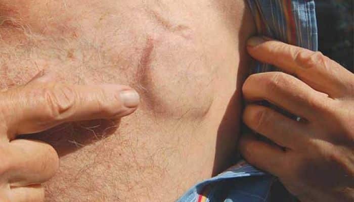 Si eres portador de marcapasos, ten en cuenta que...