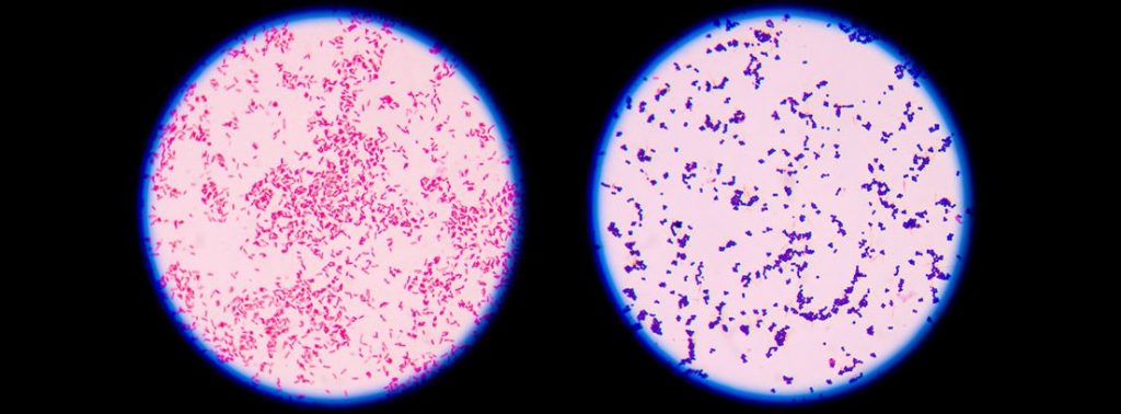 Qué es una bacteria 3 Clasificación de acuerdo a la pared celular: