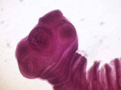 Qué es una tenia Qué es una tenia