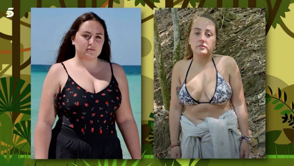 Rocío Flores el nuevo retoque estético que la ha transformado por completo