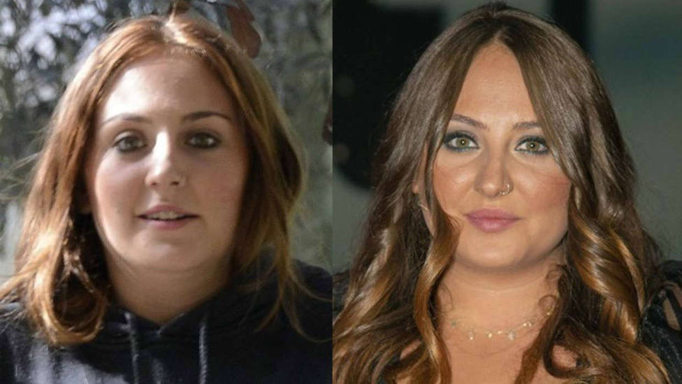 Rocío Flores el nuevo retoque estético que la ha transformado por completo