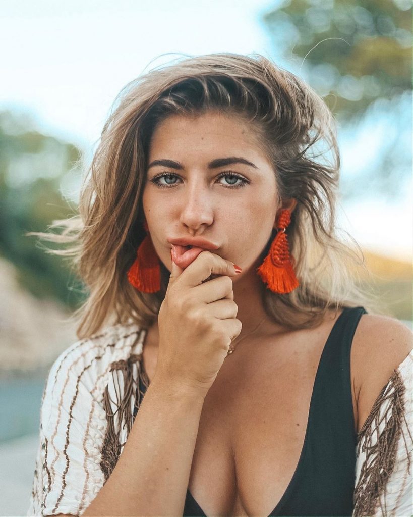 MYHYV: El antes y el impresionante después de Sophie que te dejará sin palabras