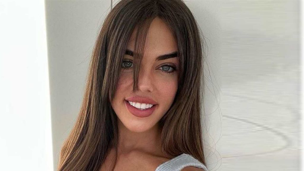 MYHYV: El antes y el impresionante después de Sophie que te dejará sin palabras