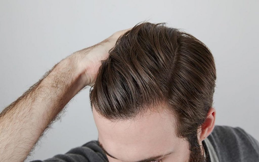 Si se te cae el cabello es porque te falta Vitamina A