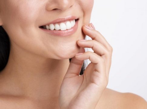 afiliacion-sonrisa-dientes sonrisa perfecta