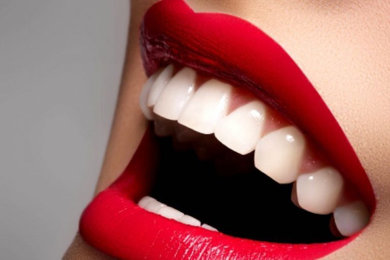Consejos para tener una sonrisa radiante